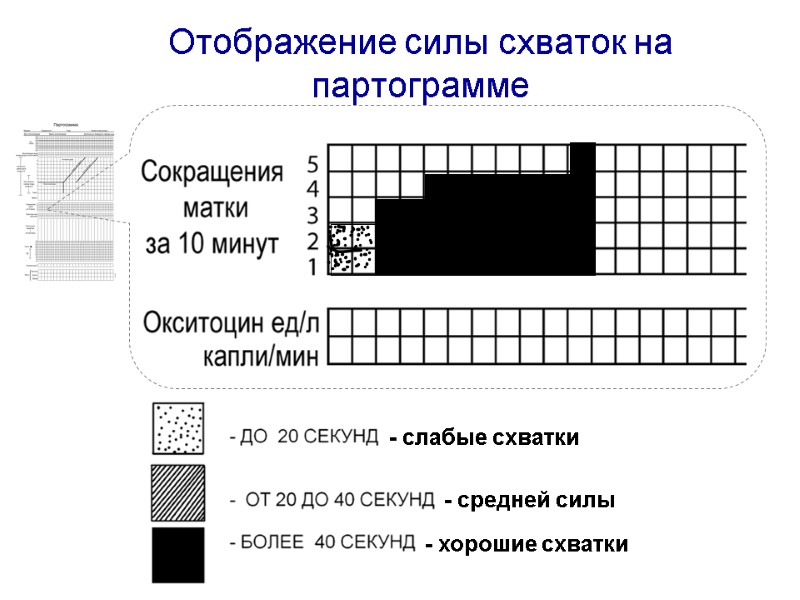 Отображение силы схваток на партограмме - слабые схватки - средней силы - хорошие схватки